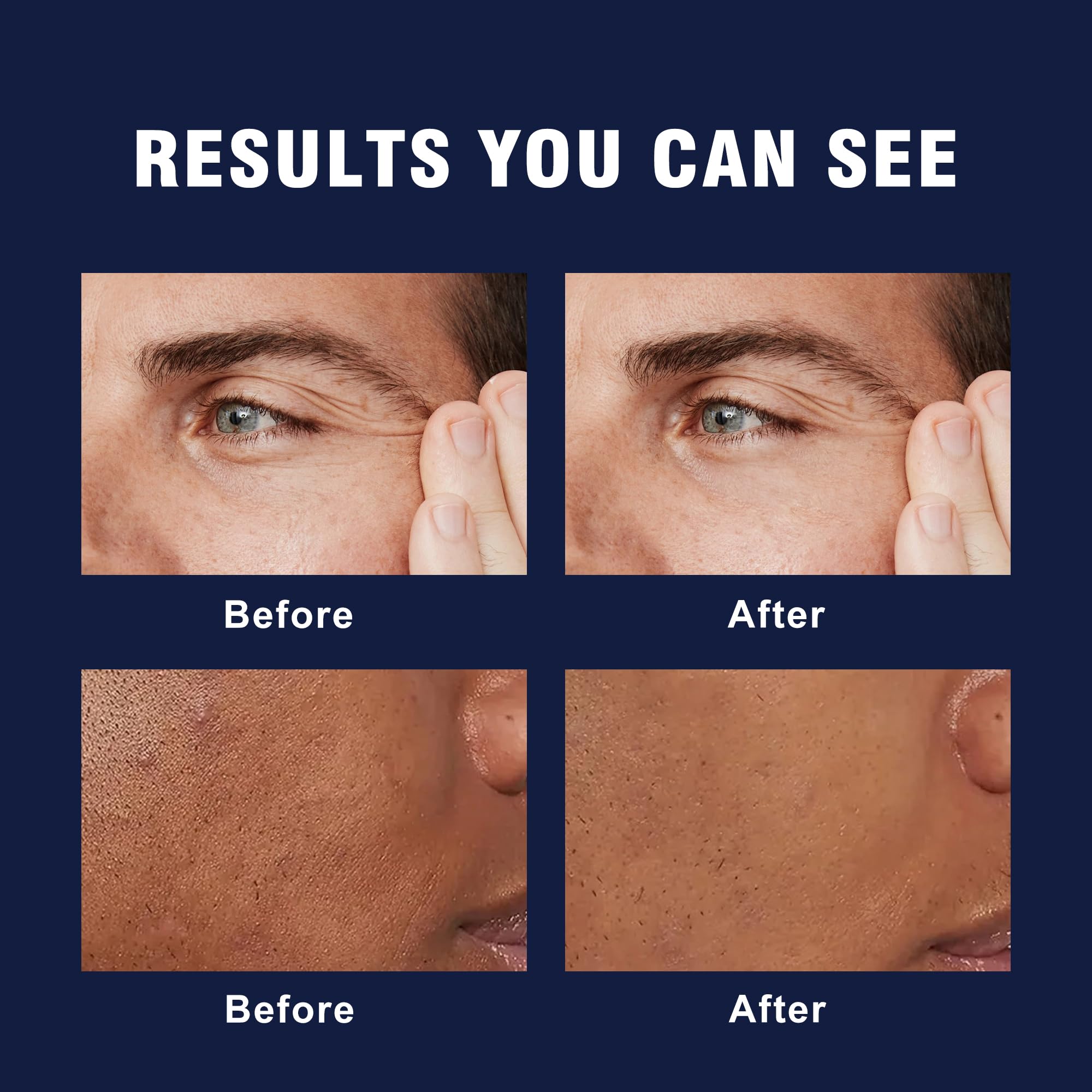 AVITAPURE 6-in-1 Face Cream for Men – Anti-Aging, Hydration & Firmness