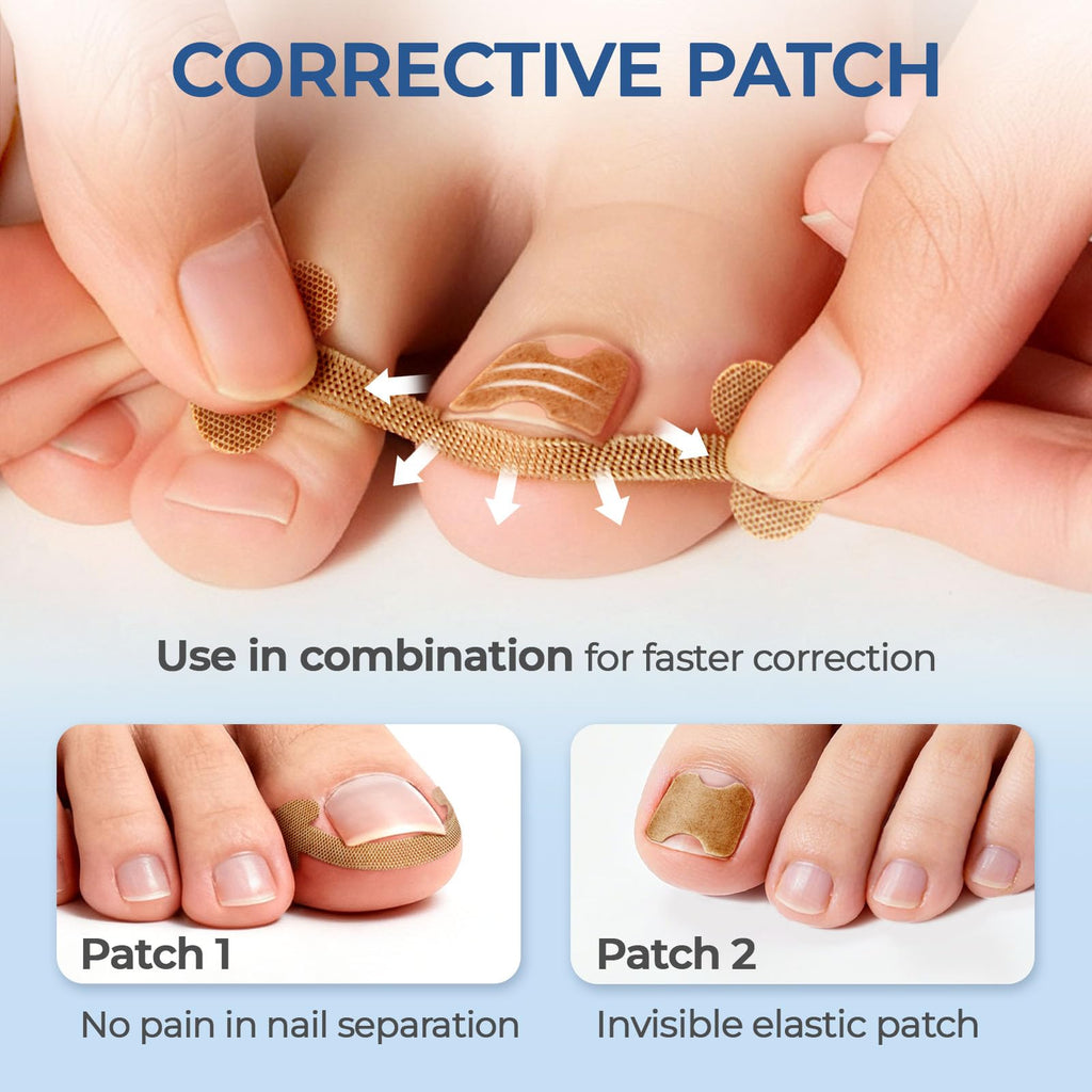 awrose Ingrown Toenail Corrector Set with Correction Strips | At-Home Pedicure Kit for Men & Women