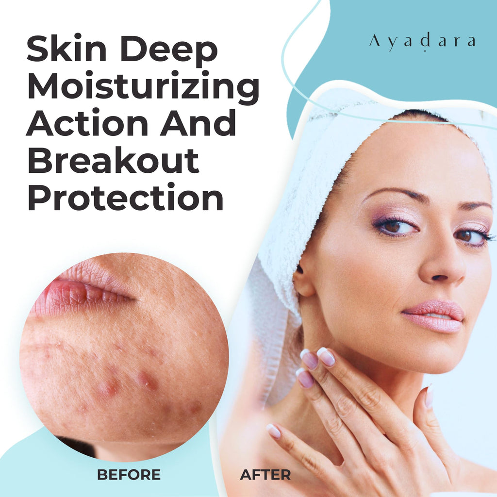 AYADARA Moisturizing Acne Cream – Salicylic Acid Face Moisturizer for Oily & Acne-Prone Skin