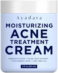 AYADARA Moisturizing Acne Cream – Salicylic Acid Face Moisturizer for Oily & Acne-Prone Skin