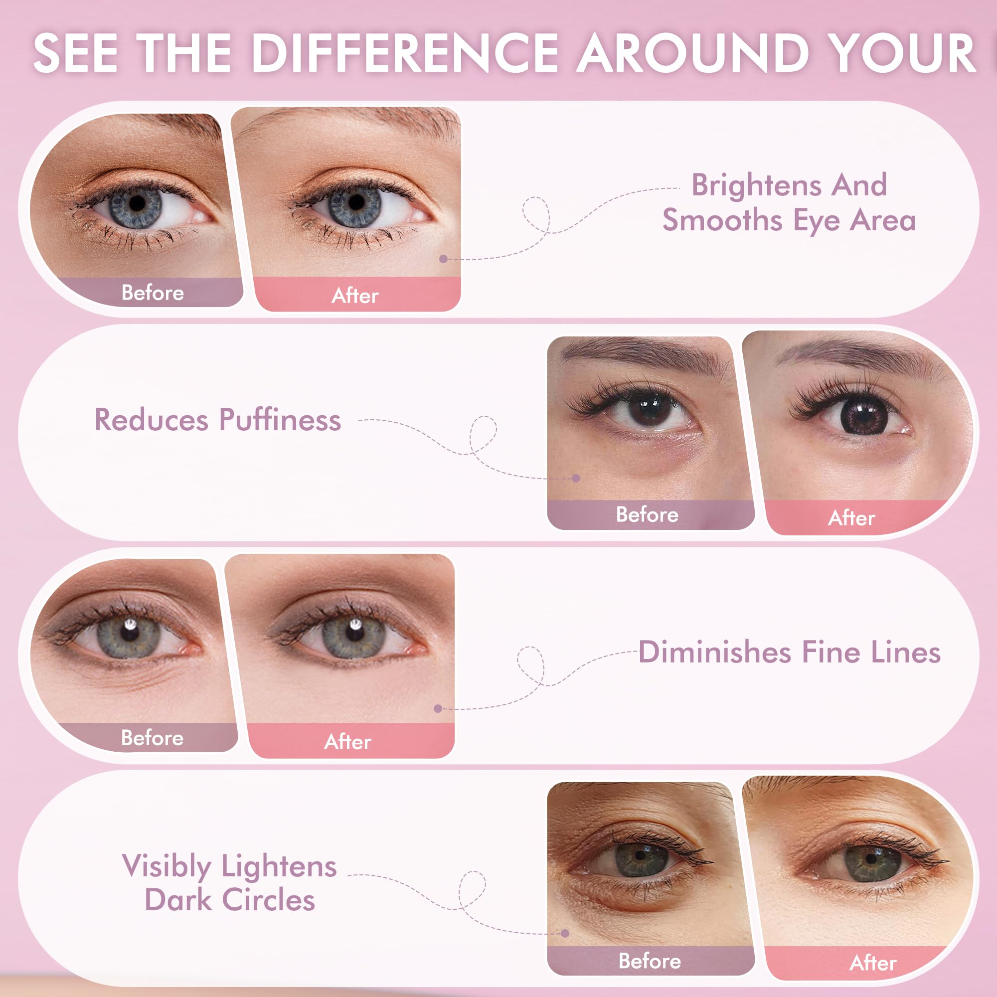 AzLucaky Rose Hydrogel Eye Patches — 40 Pairs for Puffy Eyes, Dark Circles, Hydration