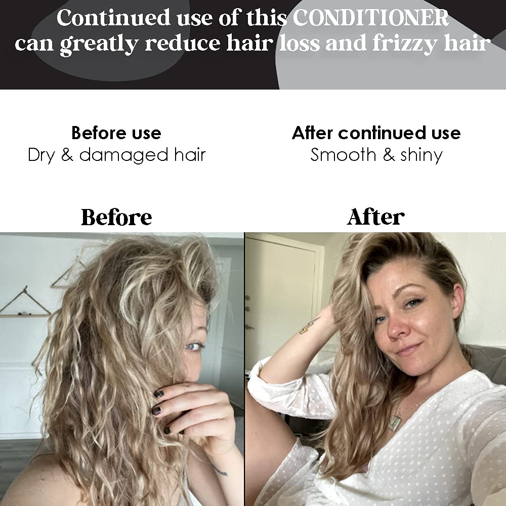 Biotin Hair Conditioner for Thinning Hair – Moisturizing Aloe Vera & Cucumber | B THE PRODUCT 8.5oz