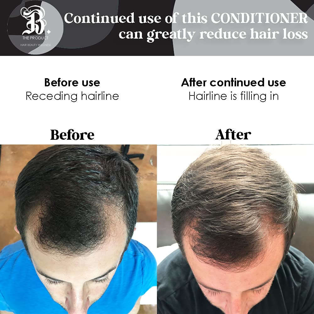 Biotin Hair Conditioner for Thinning Hair – Moisturizing Aloe Vera & Cucumber | B THE PRODUCT 8.5oz