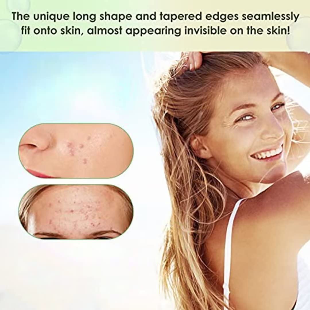 BAGLAK Large Blemish Patches – 22 XL Hydrocolloid Patches for Face