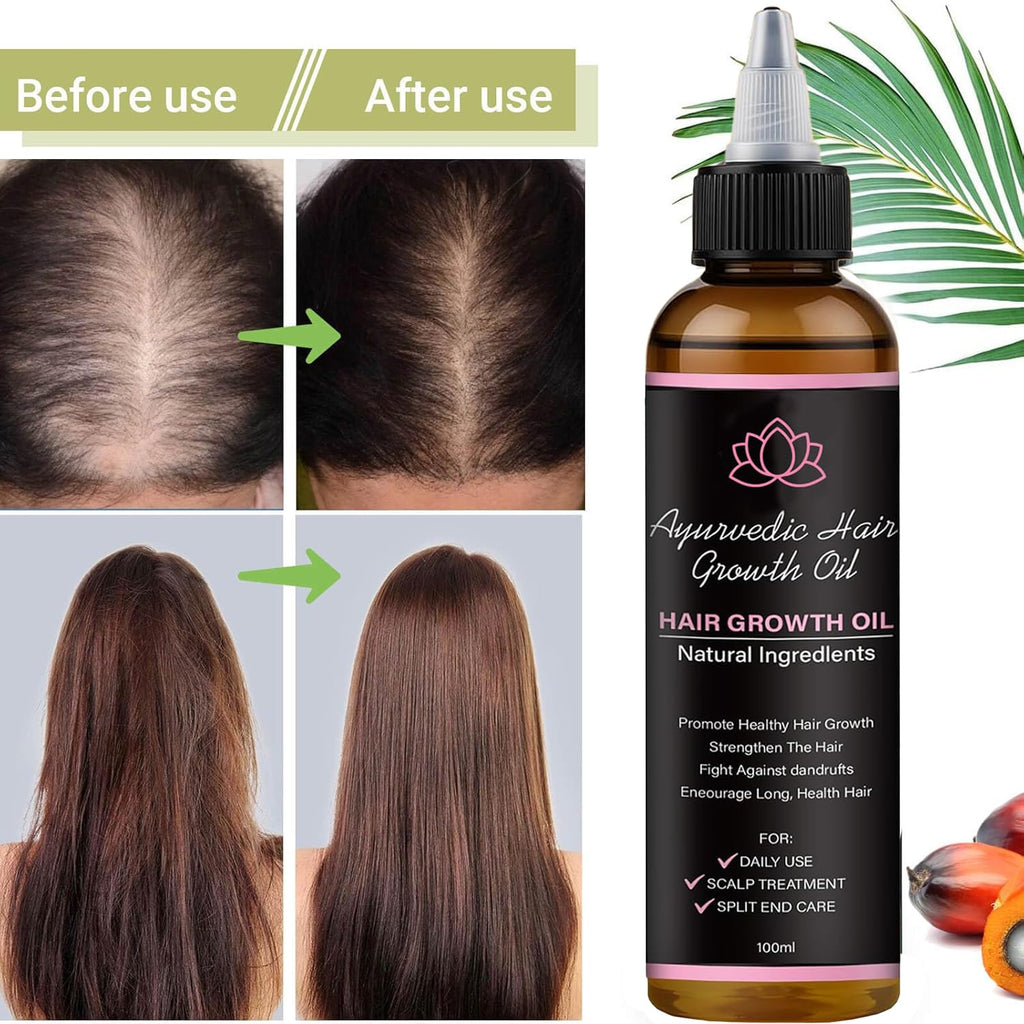 BALPPRD Lifewitqueenp Hair Growth Oil — Ayurvedic Care for All Hair Types