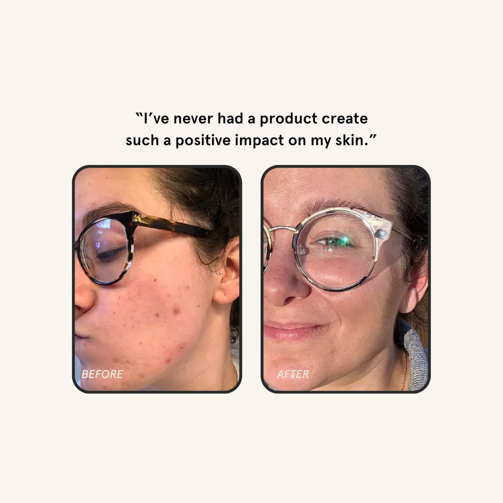 Barefaced Overachiever 1 Oz – 10-in-1 Skin Booster with Bakuchiol, Resveratrol & Green Tea