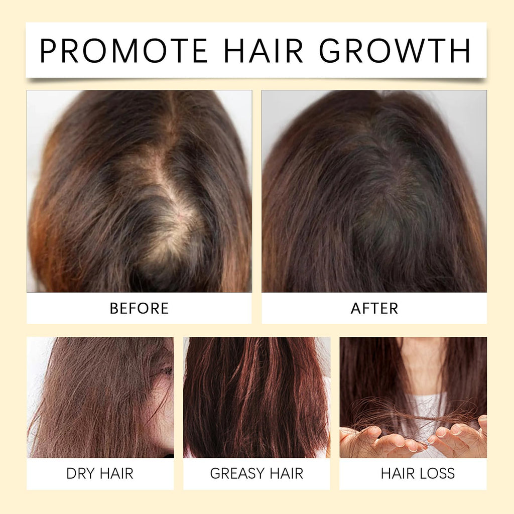 Batana Oil for Hair Growth – 4-in-1 Rosemary, Castor & Pumpkin Seed Formula