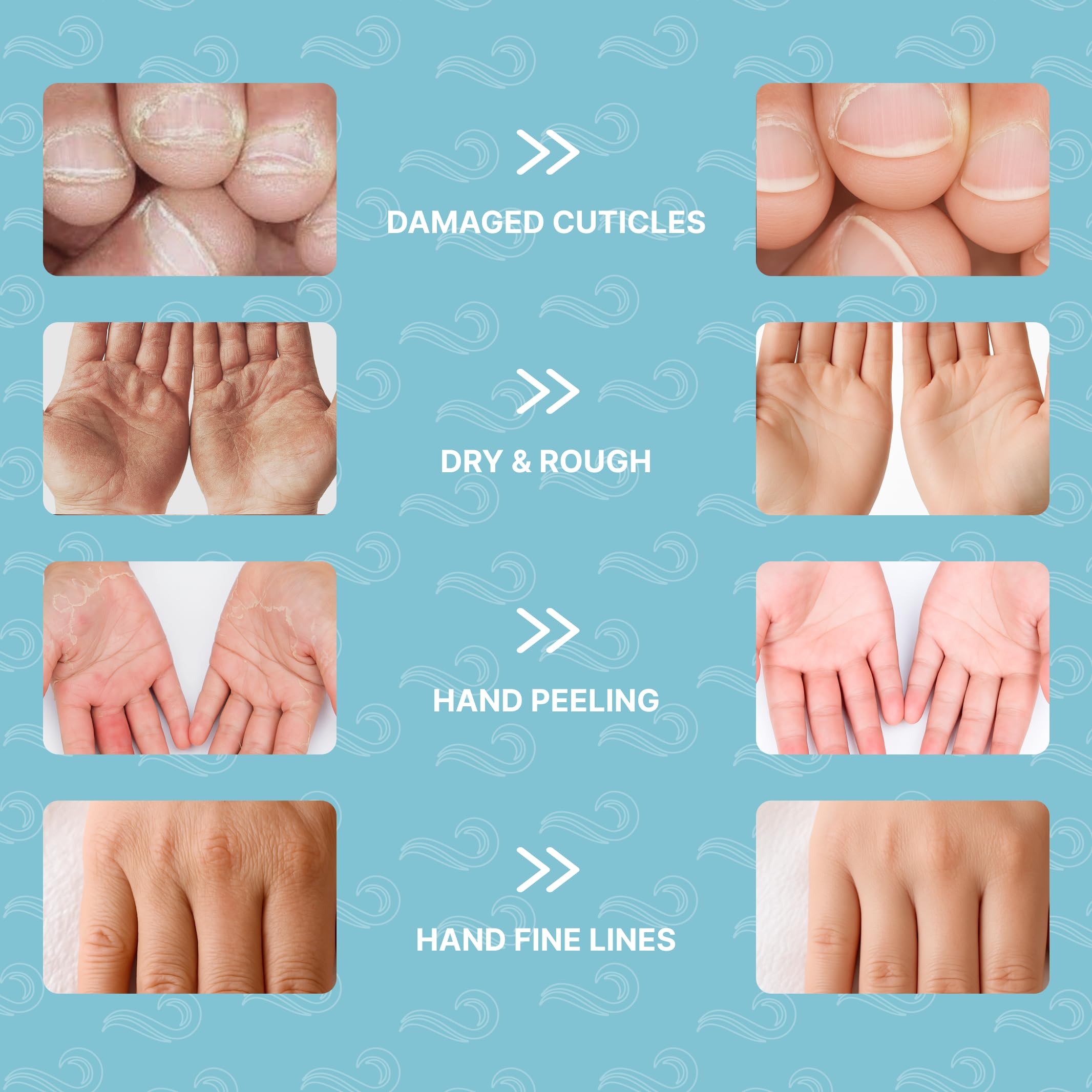 Bayside Hand Mask Moisturizing Gloves - Deep Hydration with Snail Mucin