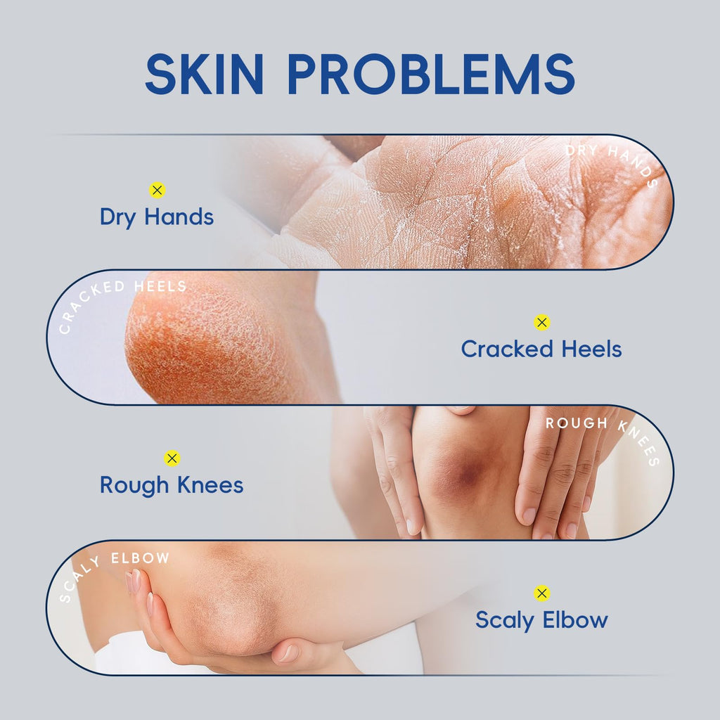 BeauBase 2 Pack Urea Cream 40% + 2% Salicylic Acid – Deep Hydration for Feet & Hands (3.53 oz)