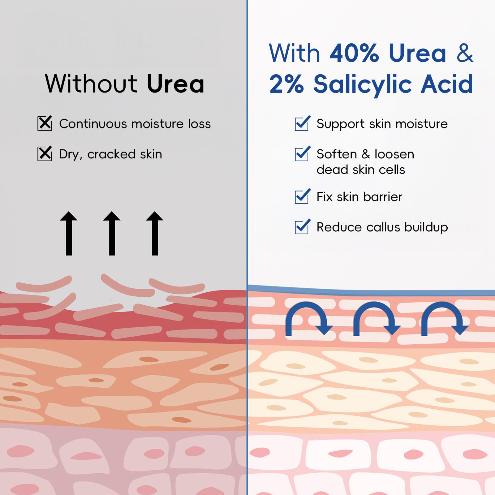 BeauBase 2 Pack Urea Cream 40% + 2% Salicylic Acid – Deep Hydration for Feet & Hands (3.53 oz)