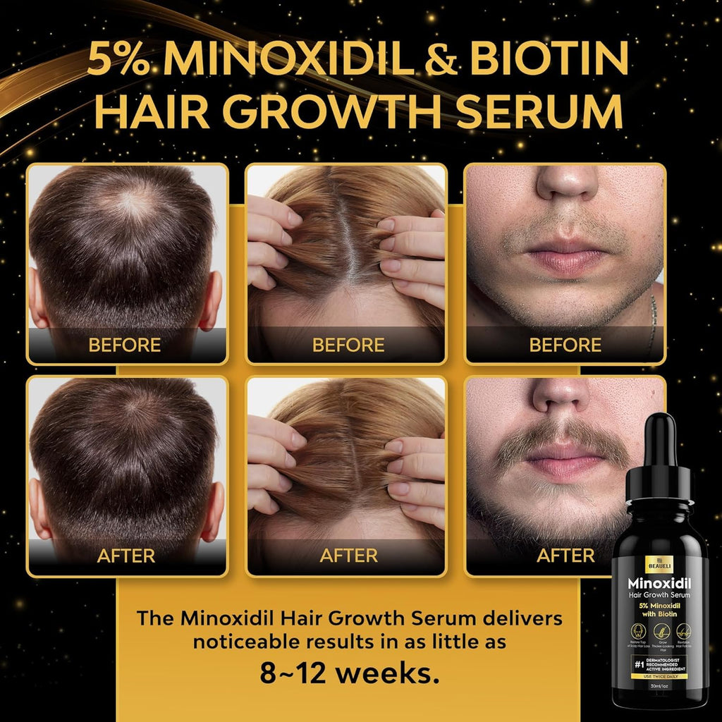 Beaueli 5% Minoxidil Hair & Beard Growth Serum – Extra Strength, Biotin, Unisex (6 Bottles)