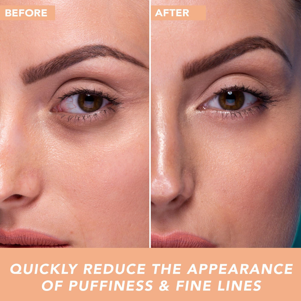 Beauty by Earth Under Eye Cream – Cooling Hyaluronic Acid Eye Gel for Dark Circles