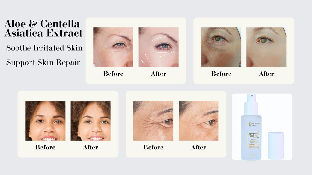 BeFabLuxx Advanced Retinol Serum – Night Anti-Aging Serum for Face & Neck with Hyaluronic, Niacinamide & Collagen
