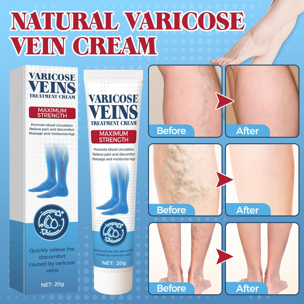 Bellisinno Varicose Veins Cream for Legs – Soothe Tired Legs, Improve Circulation
