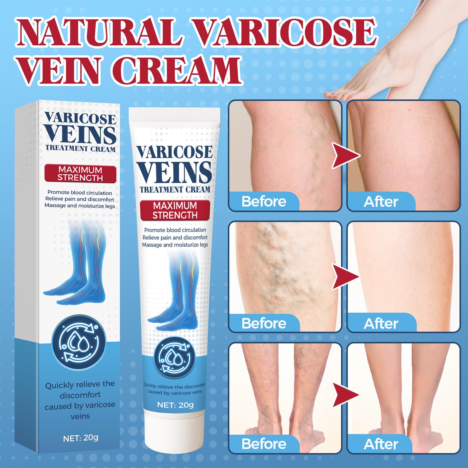Bellisinno Varicose Veins Cream for Legs – Soothe Tired Legs, Improve Circulation