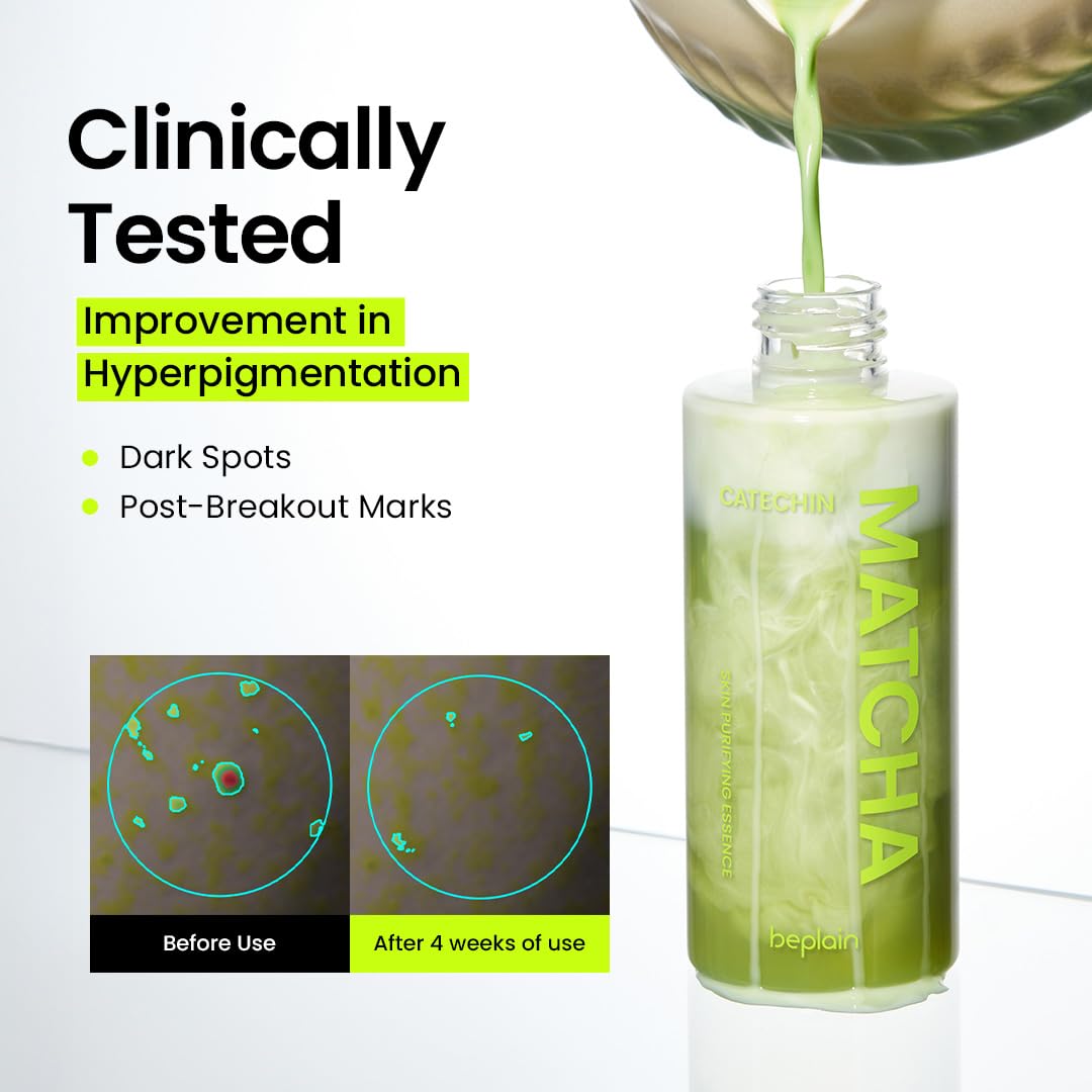 beplain Matcha Catechin Skin Purifying Essence | Hydrating & Balancing for Glowy, Healthy Skin | Sensitive Skin (150 ml)