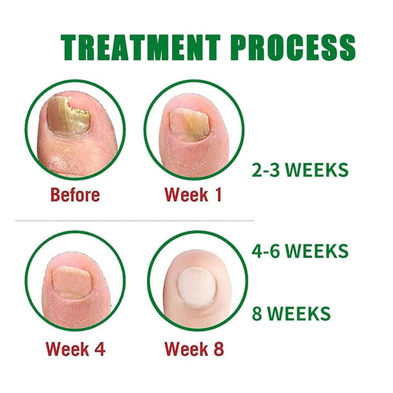 Beuifvo Nail Fungus Treatment Gel – Natural Nail Repair & Growth Serum (2pcs)