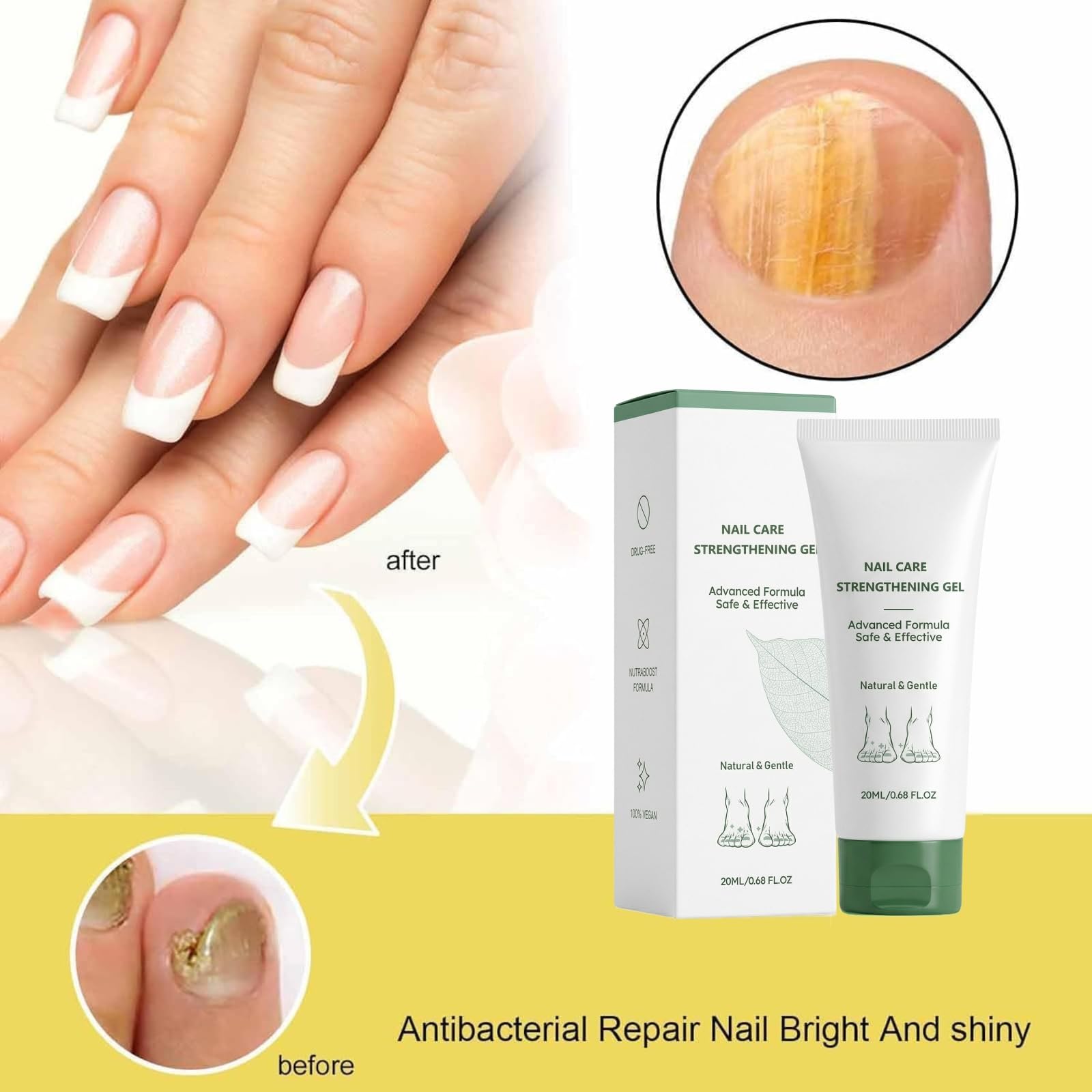 Beuifvo Nail Fungus Treatment Gel – Natural Nail Repair & Growth Serum (2pcs)