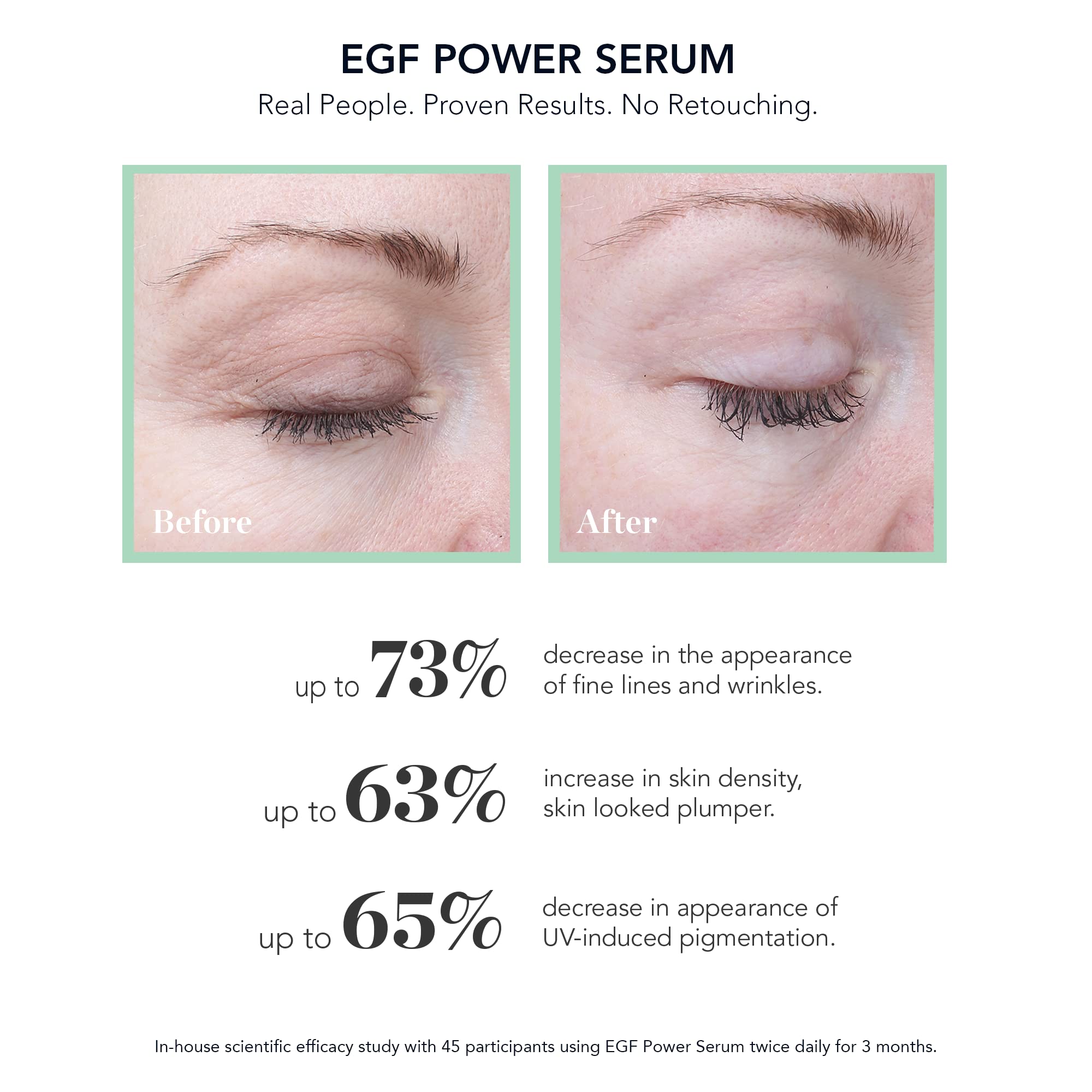 BIOEFFECT EGF Power Serum | Growth Factor Serum with EGF, KGF & Hyaluronic Acid | 15 mL