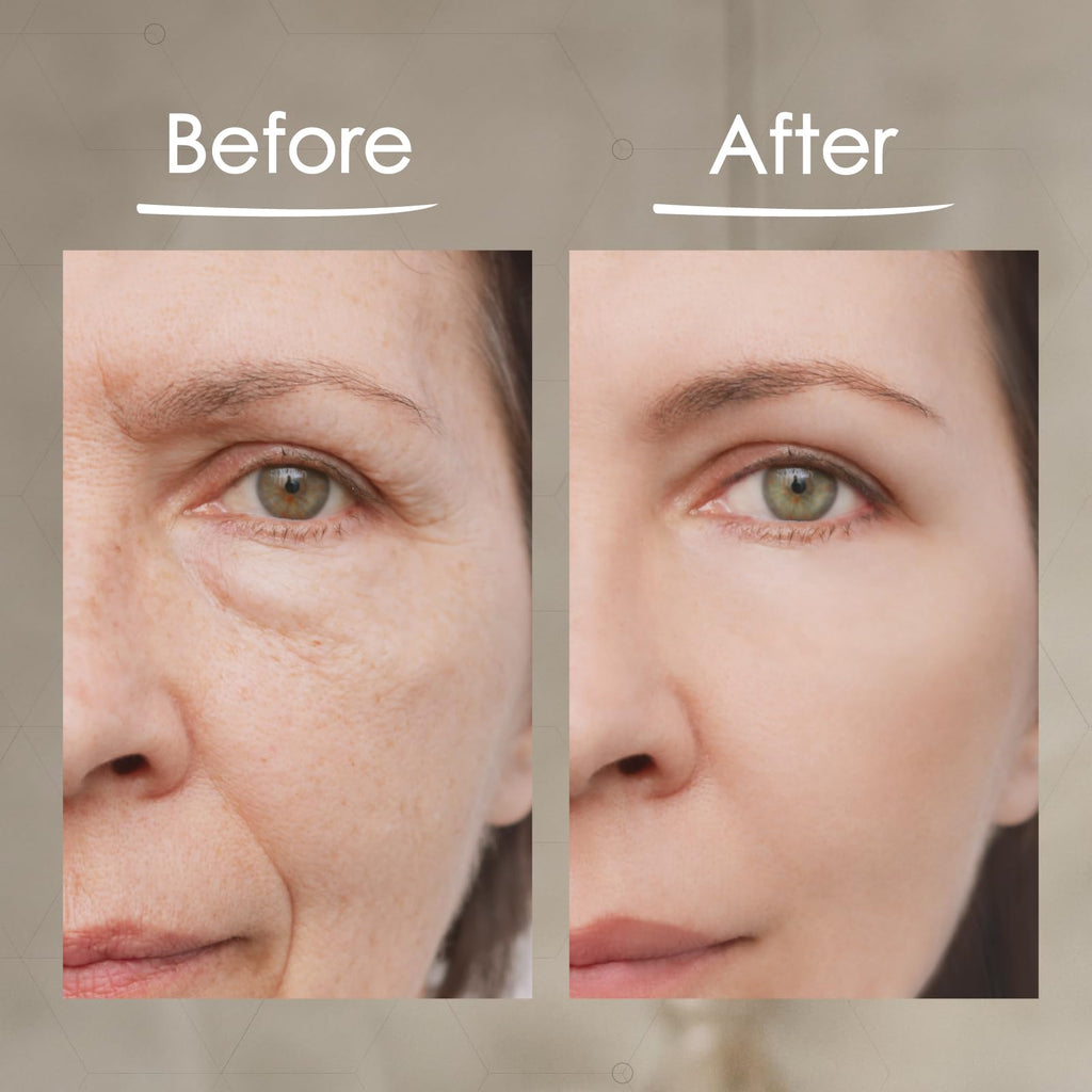 BioLogic Solutions MaxiLift Serum – Instant Face Lift & Skin Tightening Serum (Set of 2)