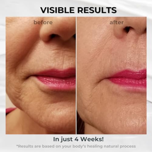 BIONOVA Anti-Aging Upper Lip Treatment with UV Chromophores – Smooth Lip Lines & Prevent Lipstick Bleed (0.5 oz)