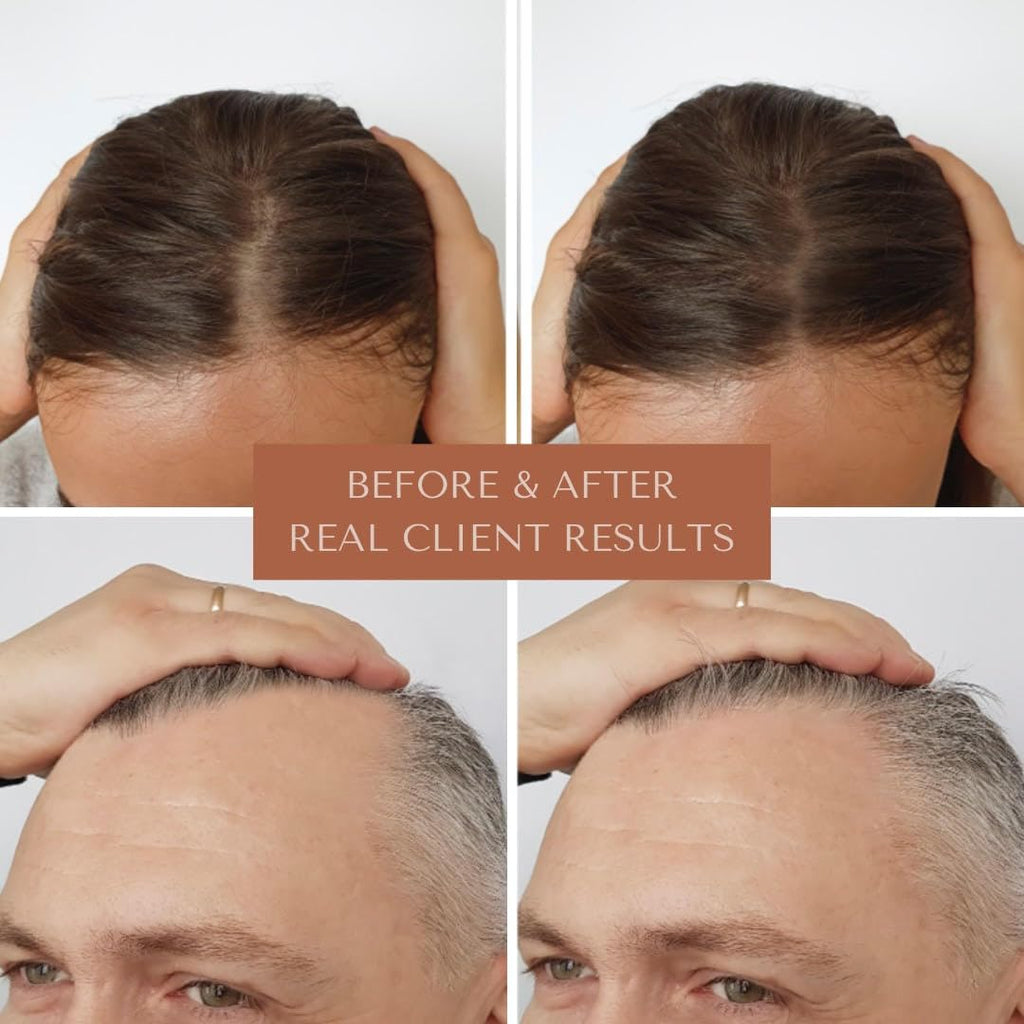 Bioregen Co Rapid Hair Growth Oil for Men & Women | Organic Rosemary, Pumpkin Seed & Batana | DHT Blocker