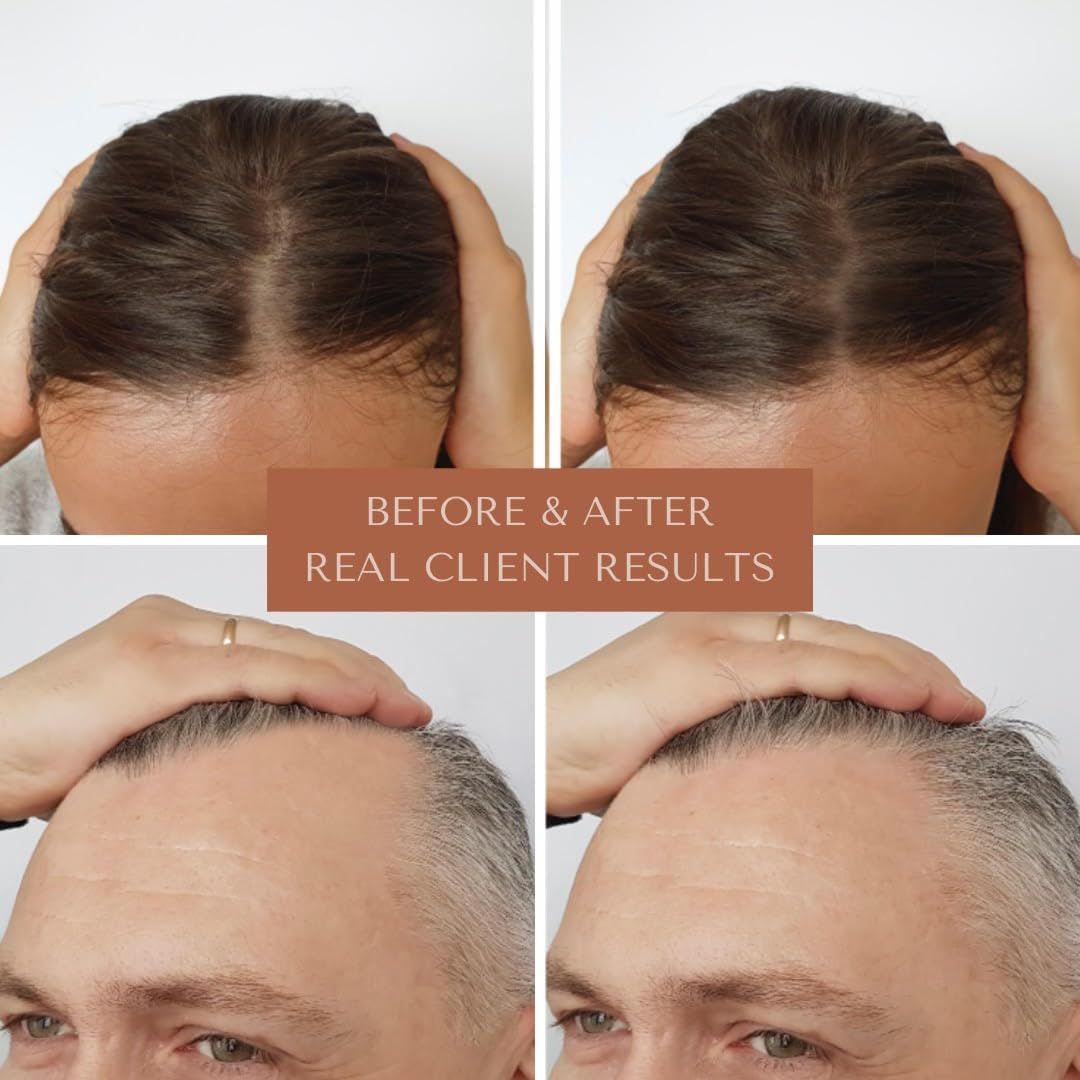 Bioregen Co Rapid Hair Growth Oil for Men & Women | Organic Rosemary, Pumpkin Seed & Batana | DHT Blocker
