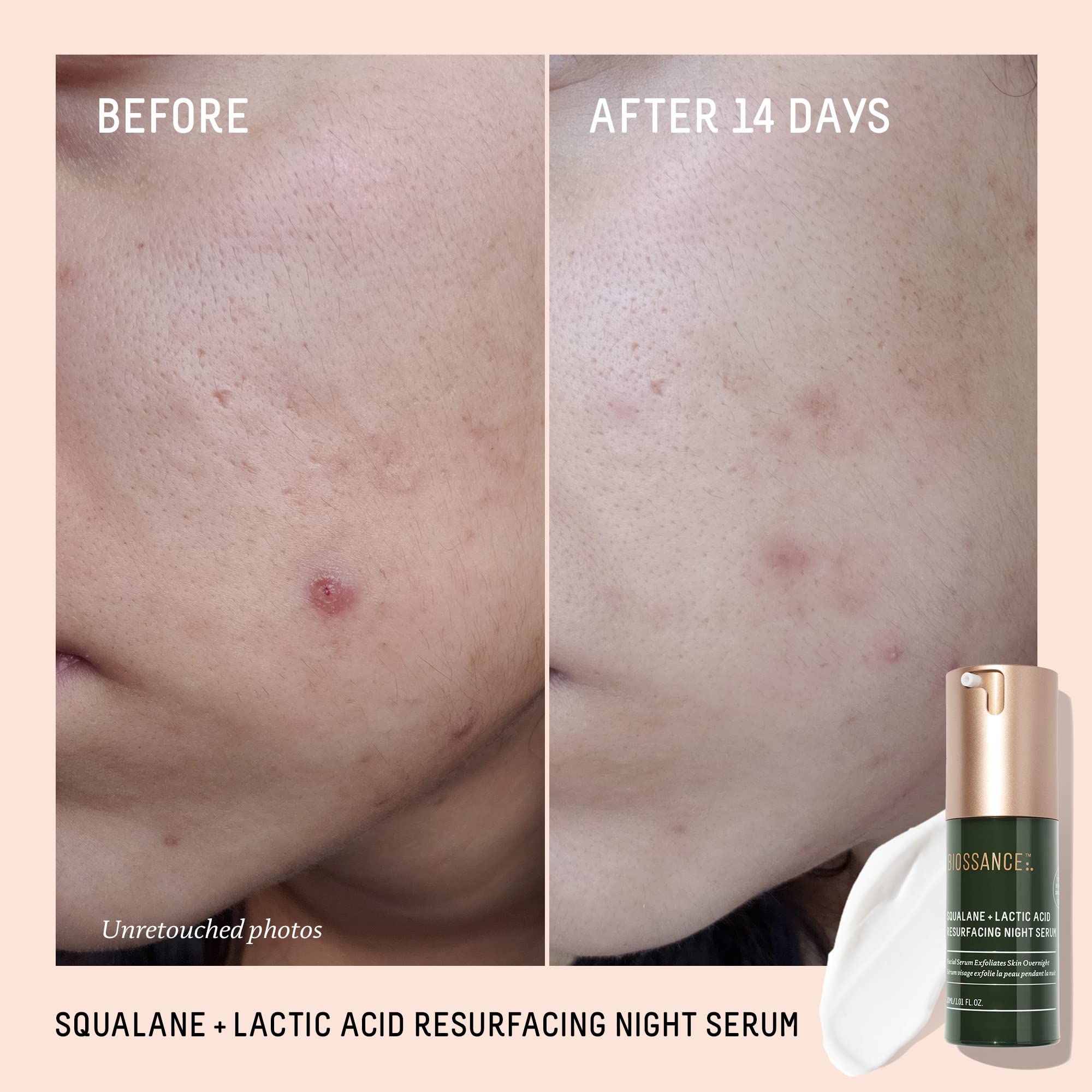BIOSSANCE Rapid Radiance Set – Hydration, Radiance & Texture Refinement