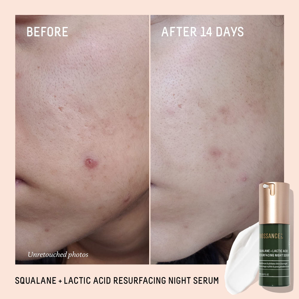 BIOSSANCE Squalane + Lactic Acid Night Serum – 10% Vegan Exfoliant for Texture, Hydration & Glow (1 oz)