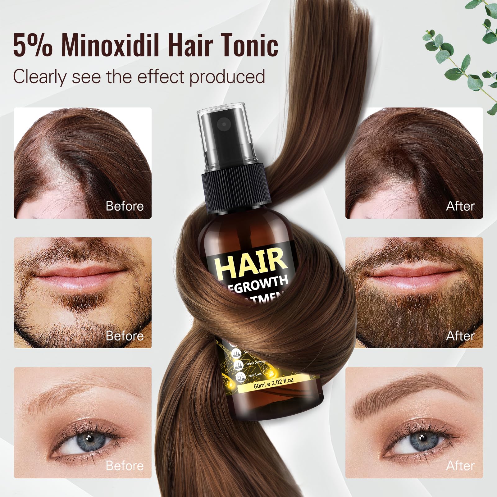 BLISSMATE 5% Minoxidil for Men & Women – Hair Regrowth Spray & Topical Solution