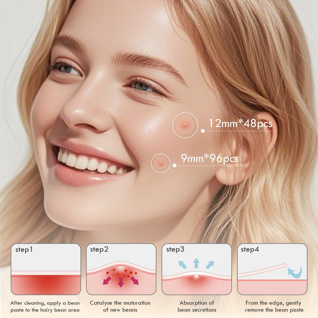 Blorfo Pimple Patches for Face – Hydrocolloid Acne Patches Set (144 Count) 9mm & 12mm with Tea Tree & Salicylic Acid