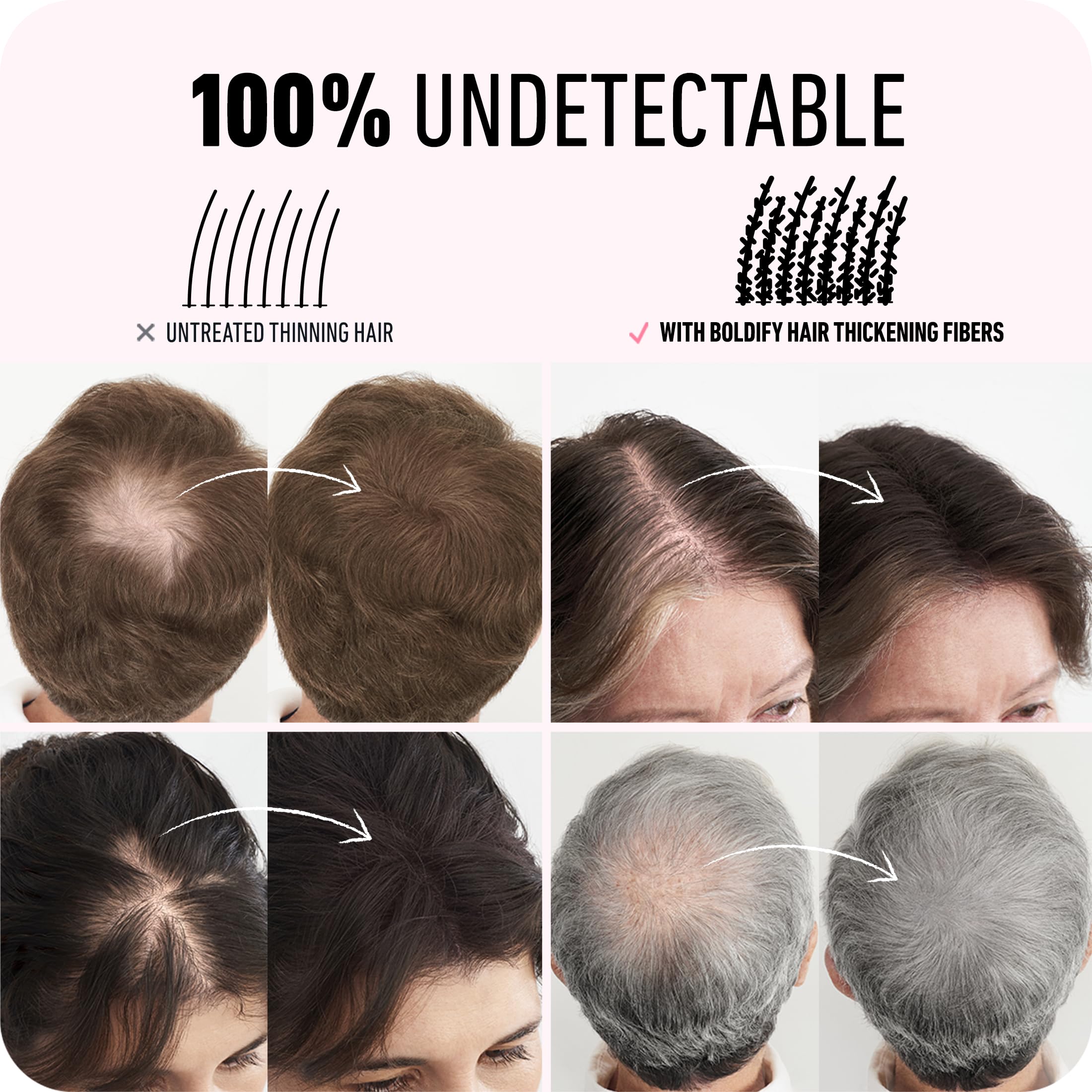 Boldify Hair Fibers (2 x 56g) – Instantly Fuller Hair, 14 Shades (Medium Brown)