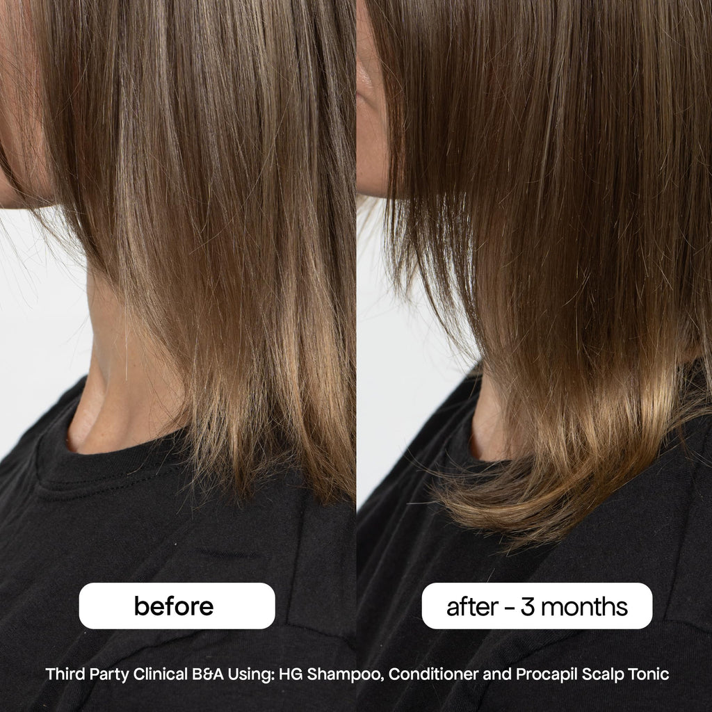 BONDIBOOST HG Anti-Thinning Shampoo – Fuller, Thicker-Looking Hair | Sulfate-Free