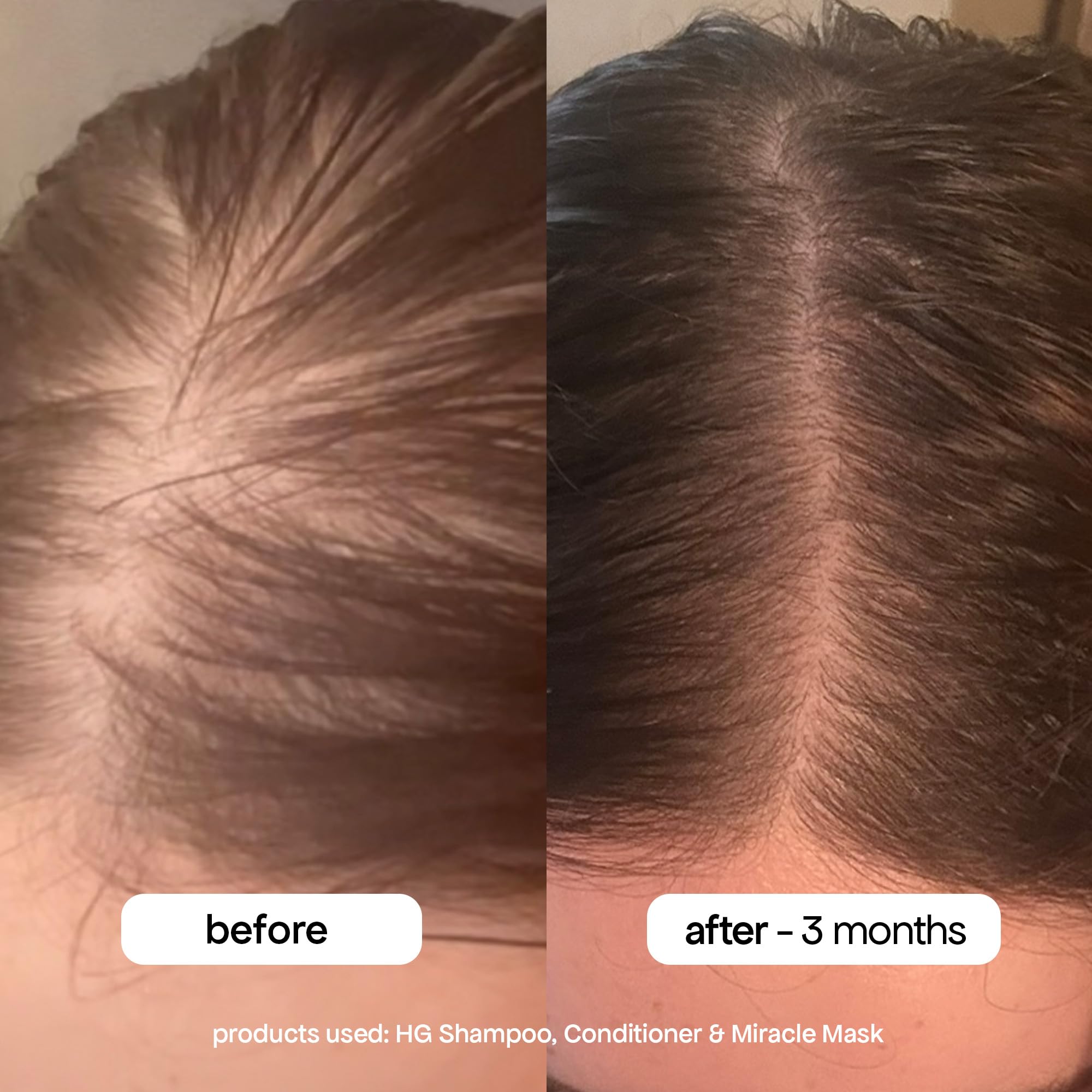 BONDIBOOST HG Anti-Thinning Shampoo – Fuller, Thicker-Looking Hair | Sulfate-Free