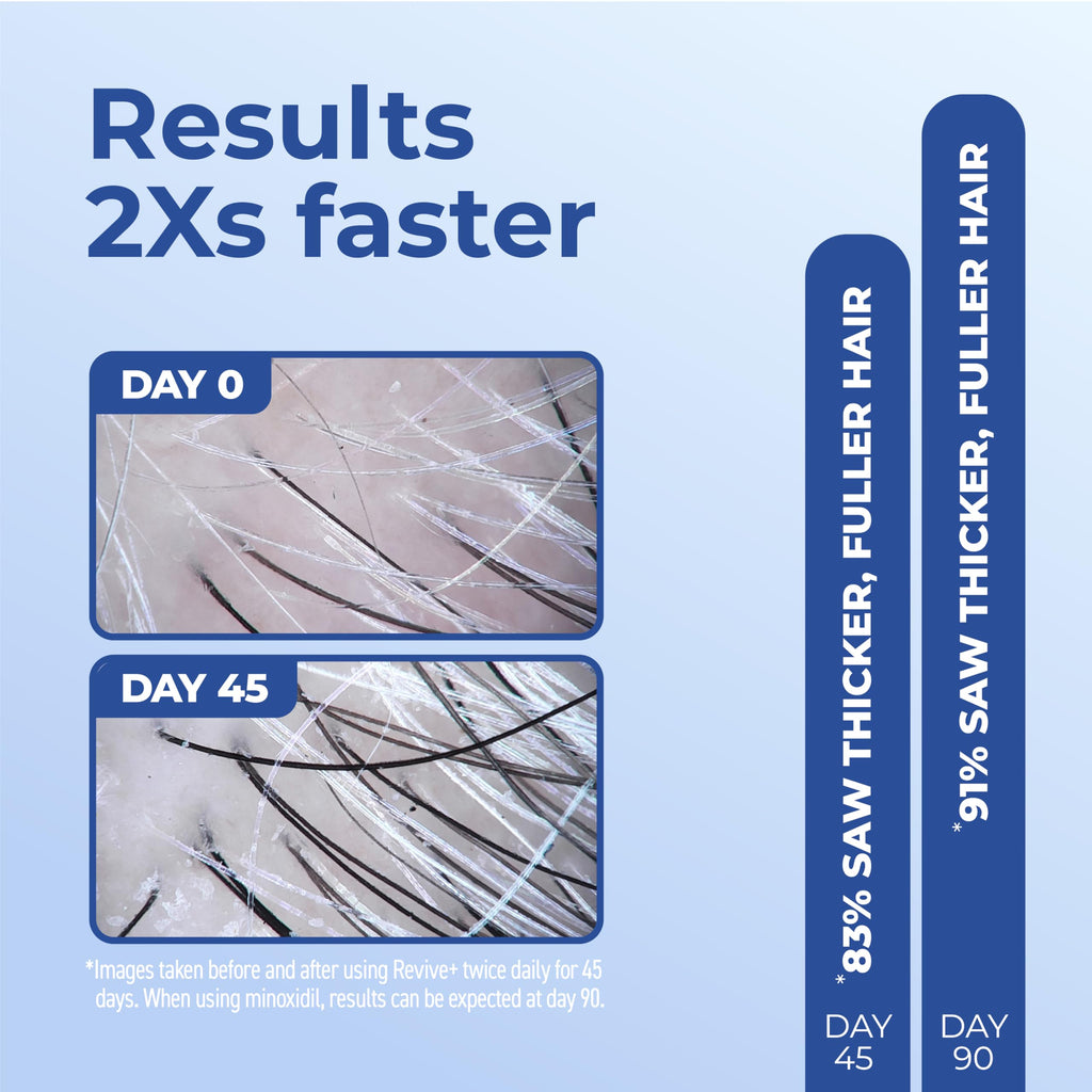 BosleyMD Revive+ Densifying Serum for Men – Drug-Free Hair Regrowth with Biotin, Saw Palmetto & Y100