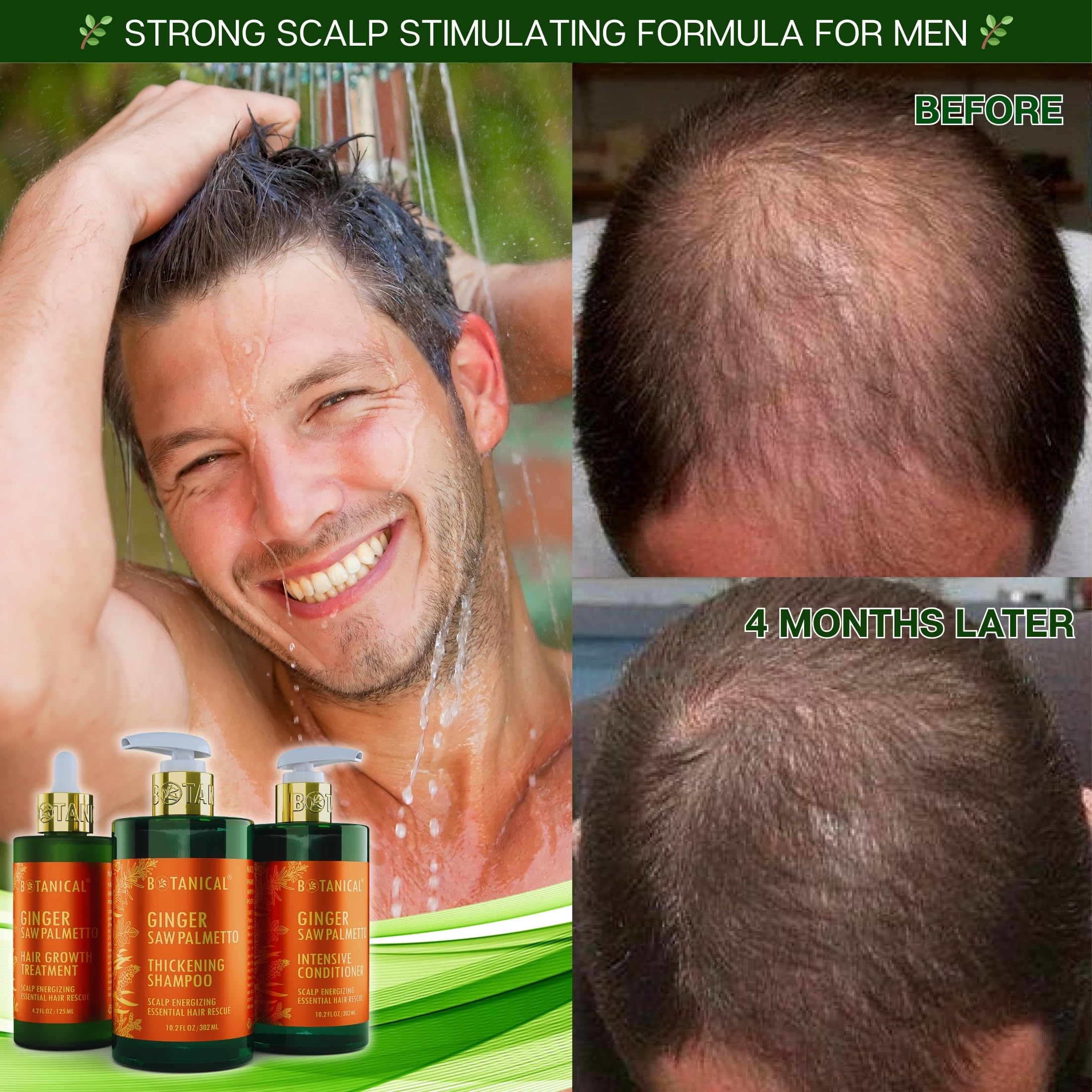 Botanical Hair Growth Lab Ginger Shampoo with Saw Palmetto – Scalp Energizing Thickening, 10.2 fl oz