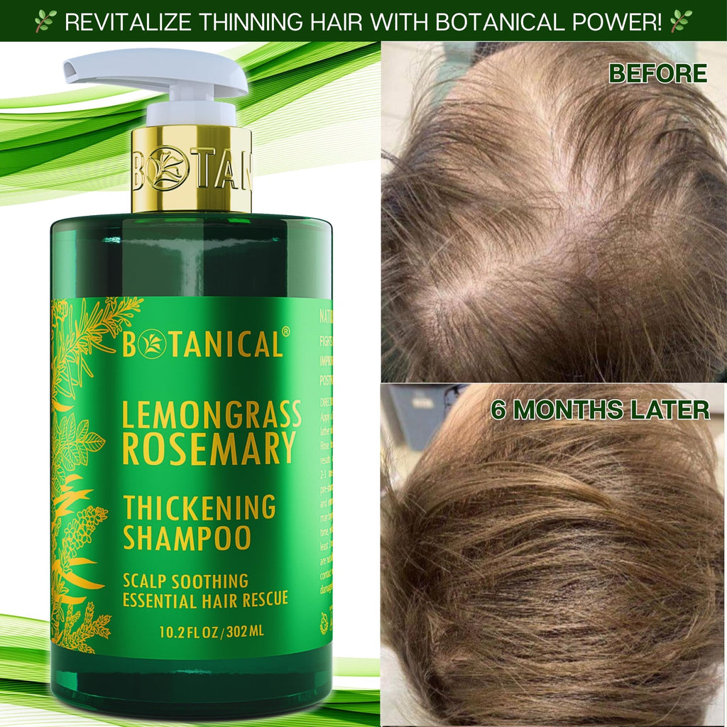 Botanical Hair Growth Lab Rosemary Shampoo with Saw Palmetto – Thinning Hair Support (10.2 oz)