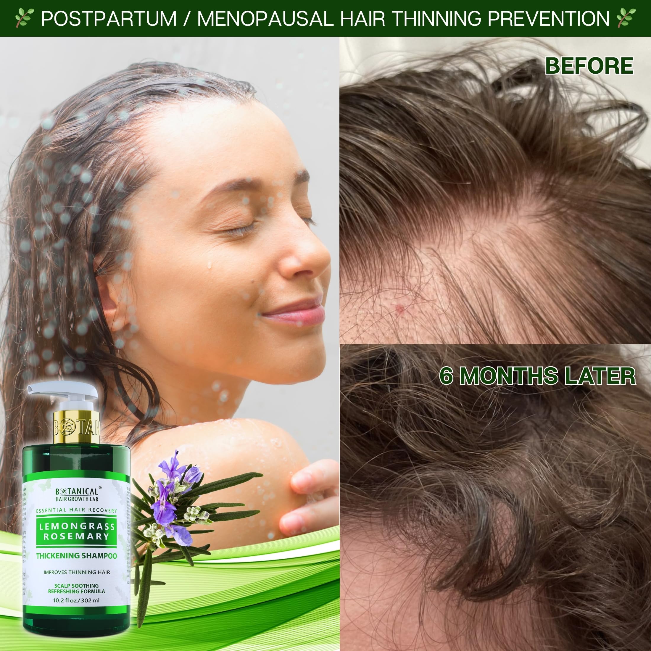 BOTANICAL HAIR GROWTH LAB Rosemary Shampoo with Saw Palmetto – Thickening & Scalp Stimulation, 10.2 oz