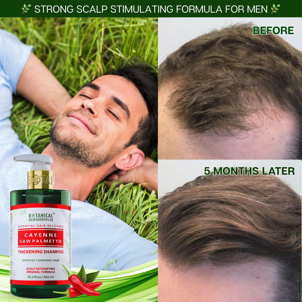 Botanical Cayenne Shampoo with Saw Palmetto – Thickening & Scalp-Stimulating | BOTANICAL HAIR GROWTH LAB 10.2 oz