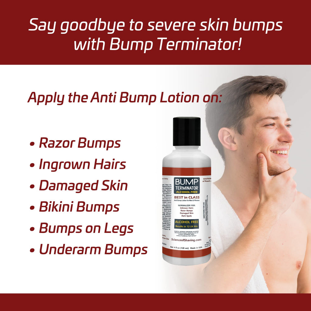 BREEJ Bump Terminator Alcohol-Free Lotion – Razor Bump Treatment for Men & Women (4 fl oz)