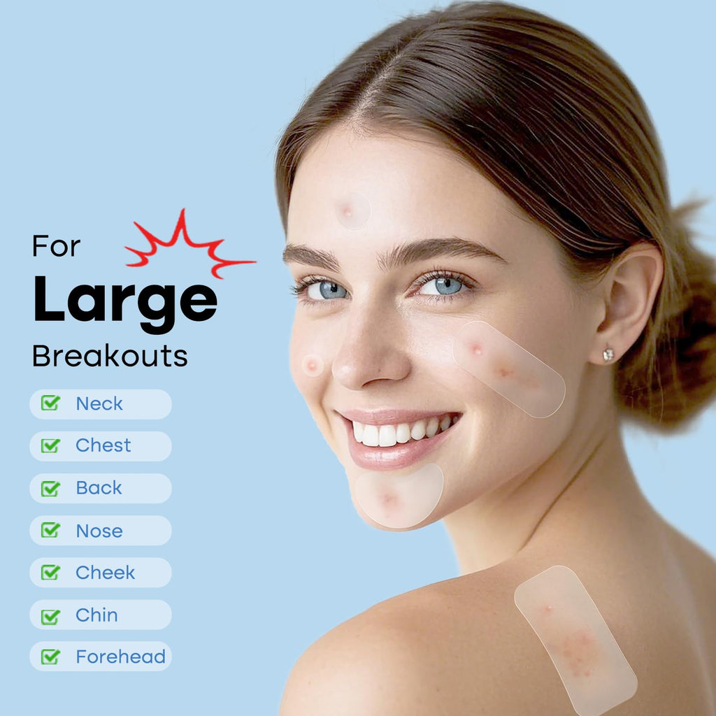 Breiboz Large Pimple Patches – 484 XL Hydrocolloid Patches for Face & Body with Tea Tree, Salicylic Acid & Cica Oil