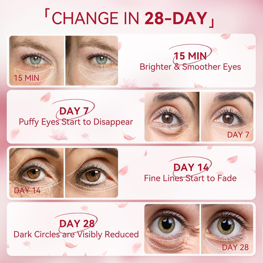 BREYLEE Rose Eye Patch – Hydrating Under Eye Patches (60 Pcs) for Puffy Eyes