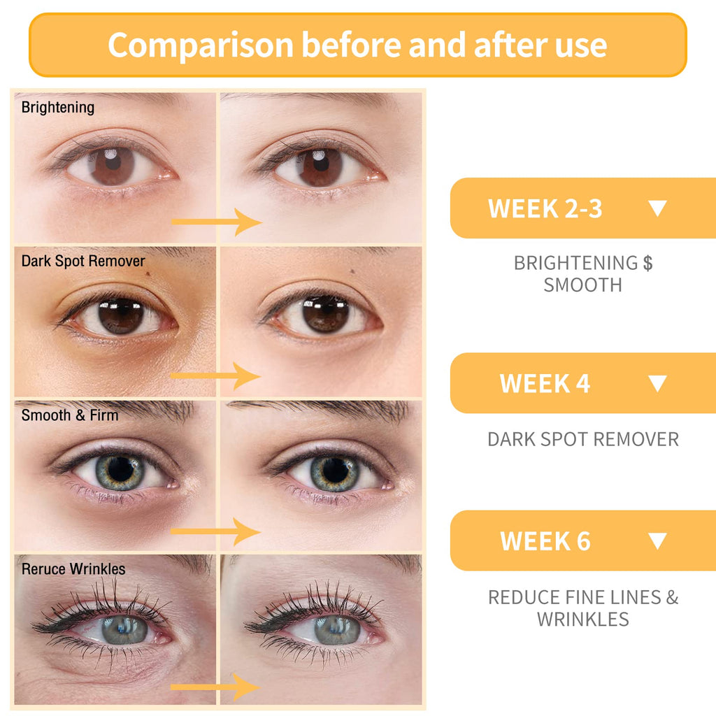 BREYLEE Vitamin C Serum for Face & Eye (0.6 oz) – Brightening, Dark Spot Reduction, Anti-Aging