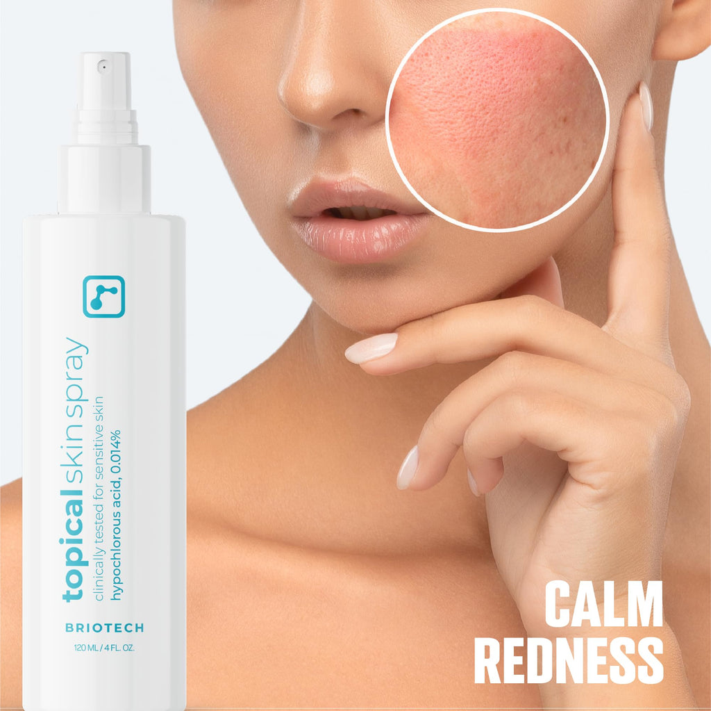 BRIOTECH Topical Skin Spray | HOCl Facial Mist for Sensitive Skin, Full-Body Irritation Support