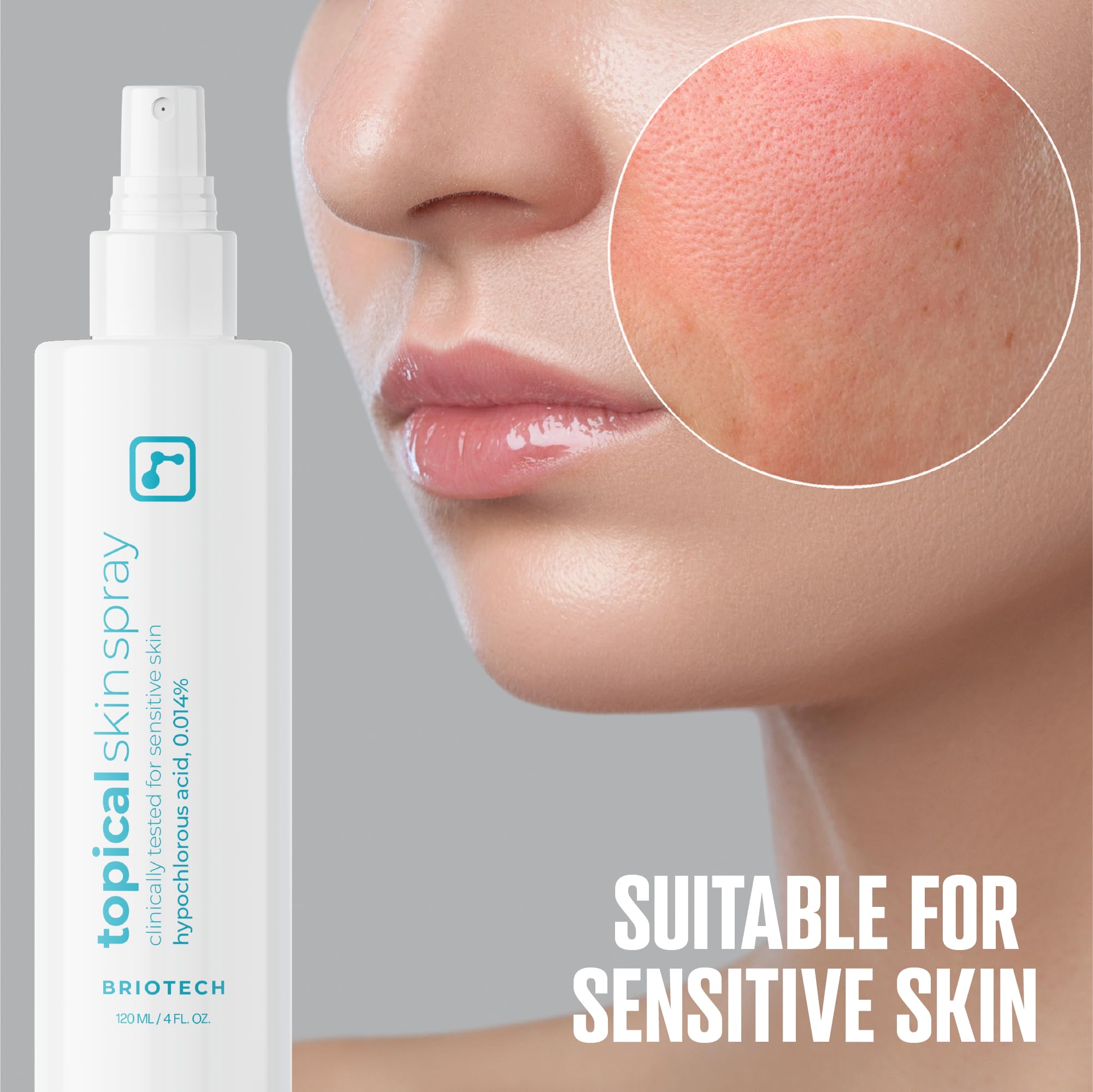BRIOTECH Topical Skin Spray | HOCl Facial Mist for Sensitive Skin, Full-Body Irritation Support
