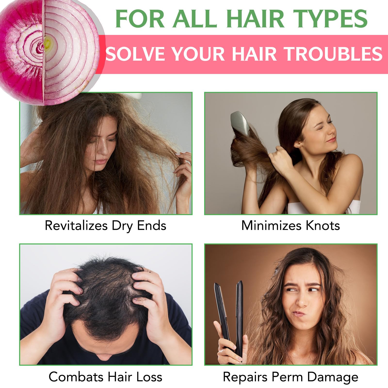 BSMKCL Onion Biotin & Rosemary Shampoo – Hair Growth, Thinning Hair & Shine (8.45 fl oz)