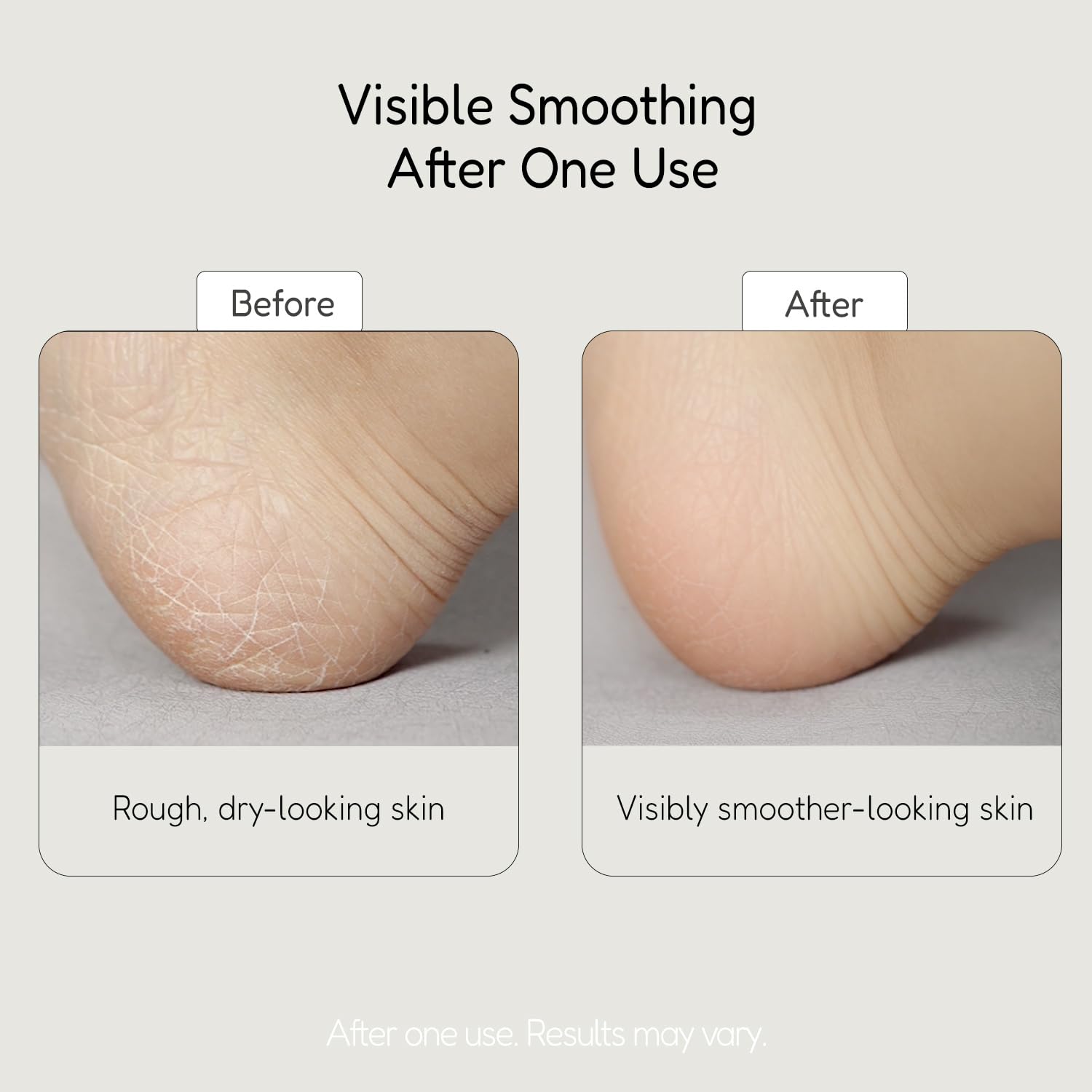 BUFFOUT Callus Eraser Exfoliating Gel – Feet, Heels, Elbows & Knees