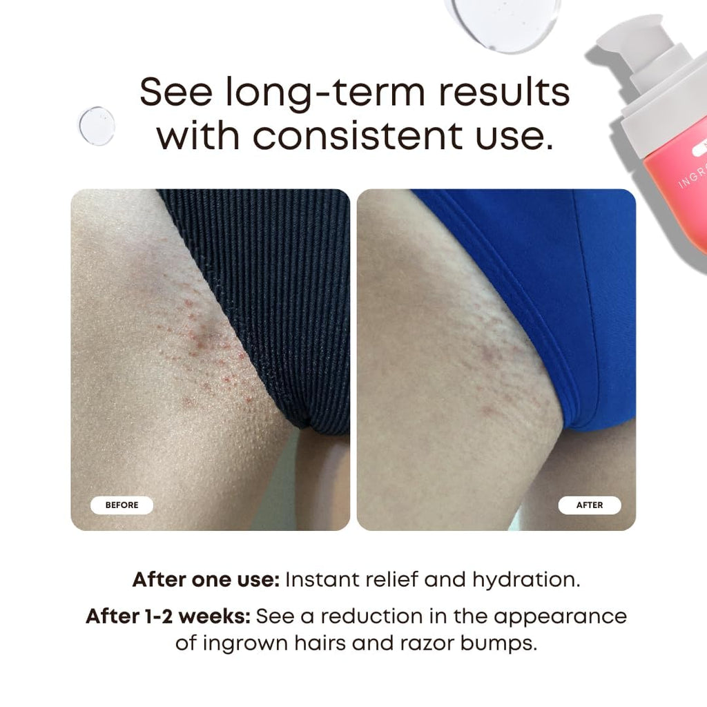 Bushbalm Ingrown Hair Oil Watermelon Sugar – Soothe Razor Bumps & Post-Shave Irritation (30 ml)