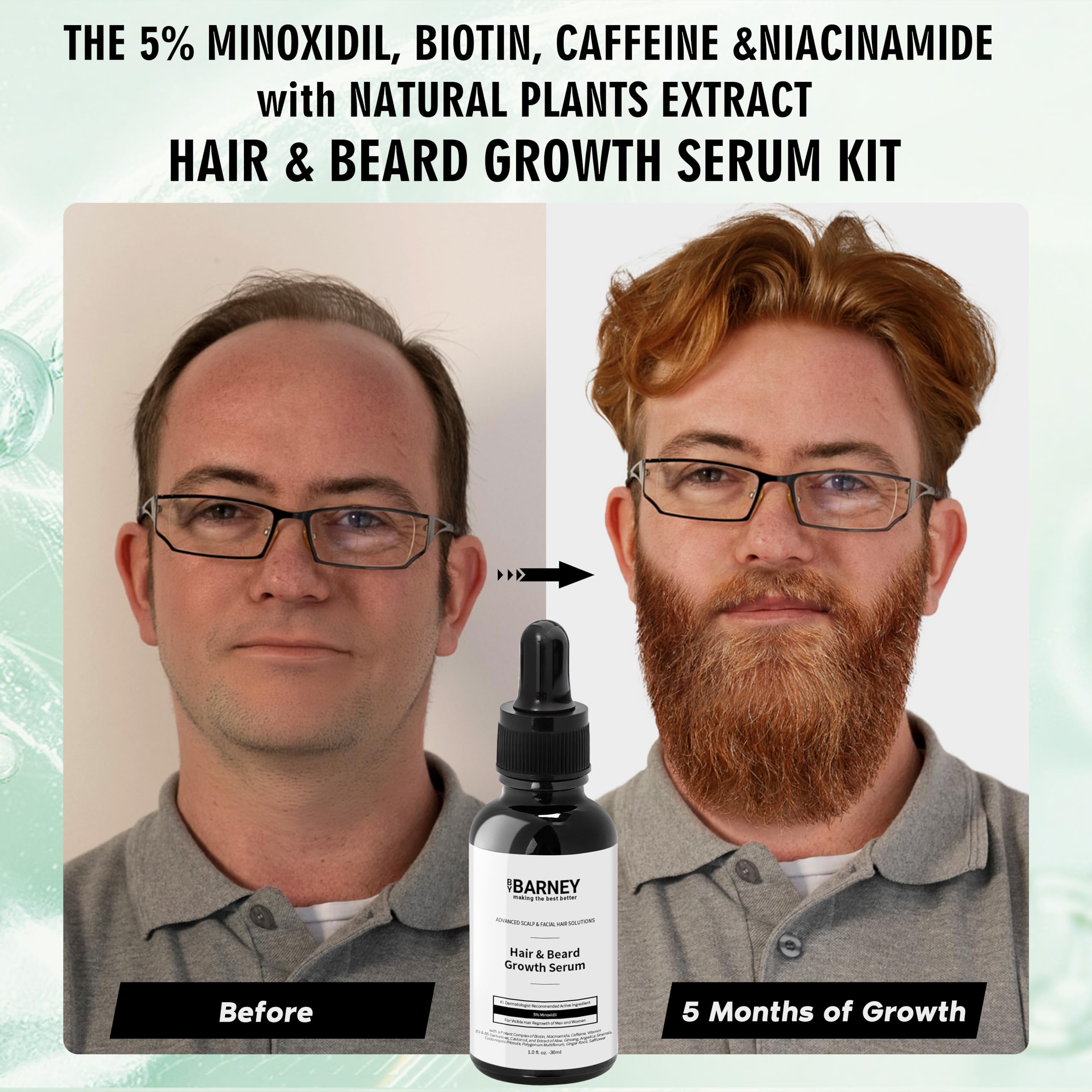 BY BARNEY 5% Minoxidil Hair & Beard Growth Serum – Natural Extracts, Biotin & Caffeine