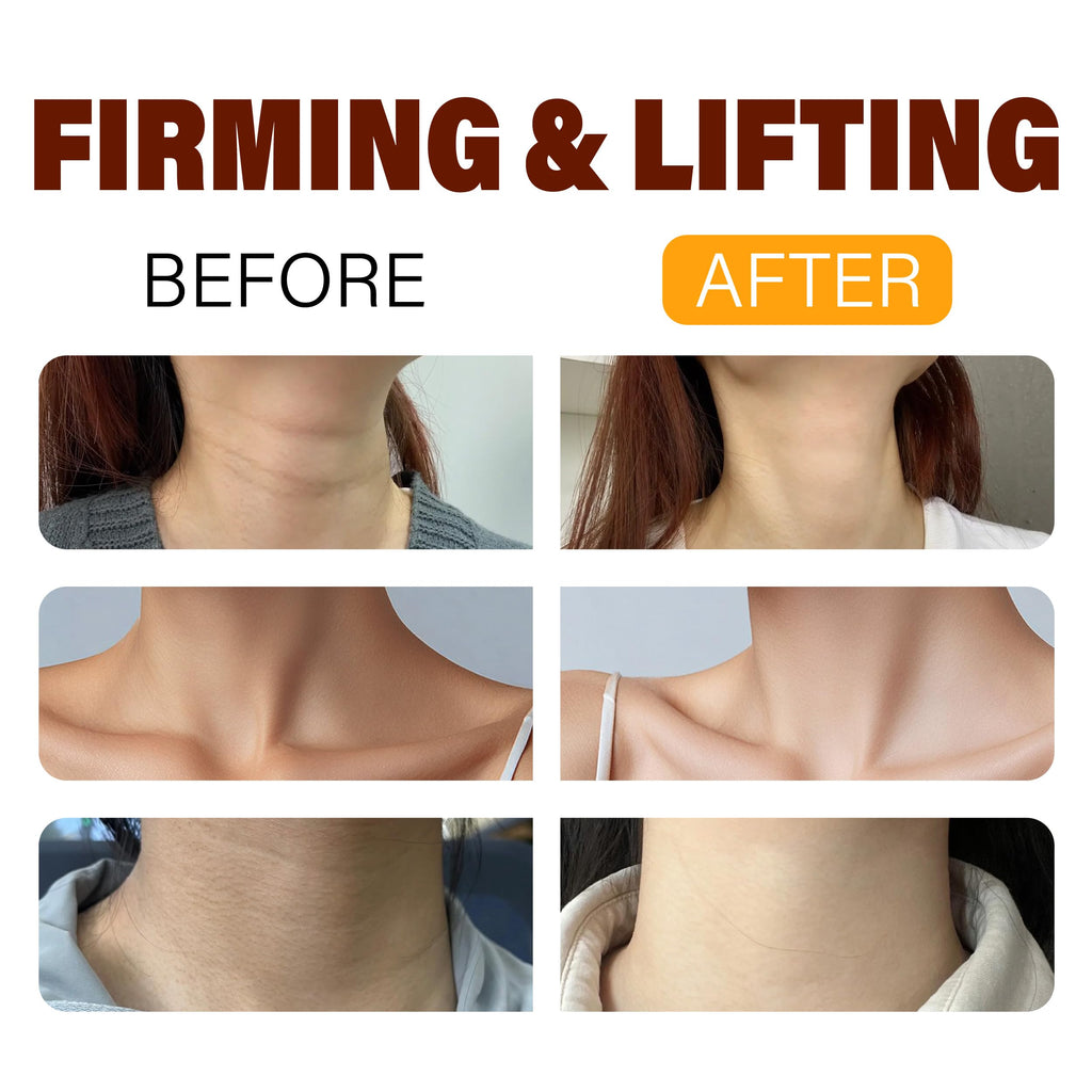 BYMOLIA Neck Firming Cream with Roller – Anti-Aging Neck & Chest, Collagen + Hyaluronic Acid